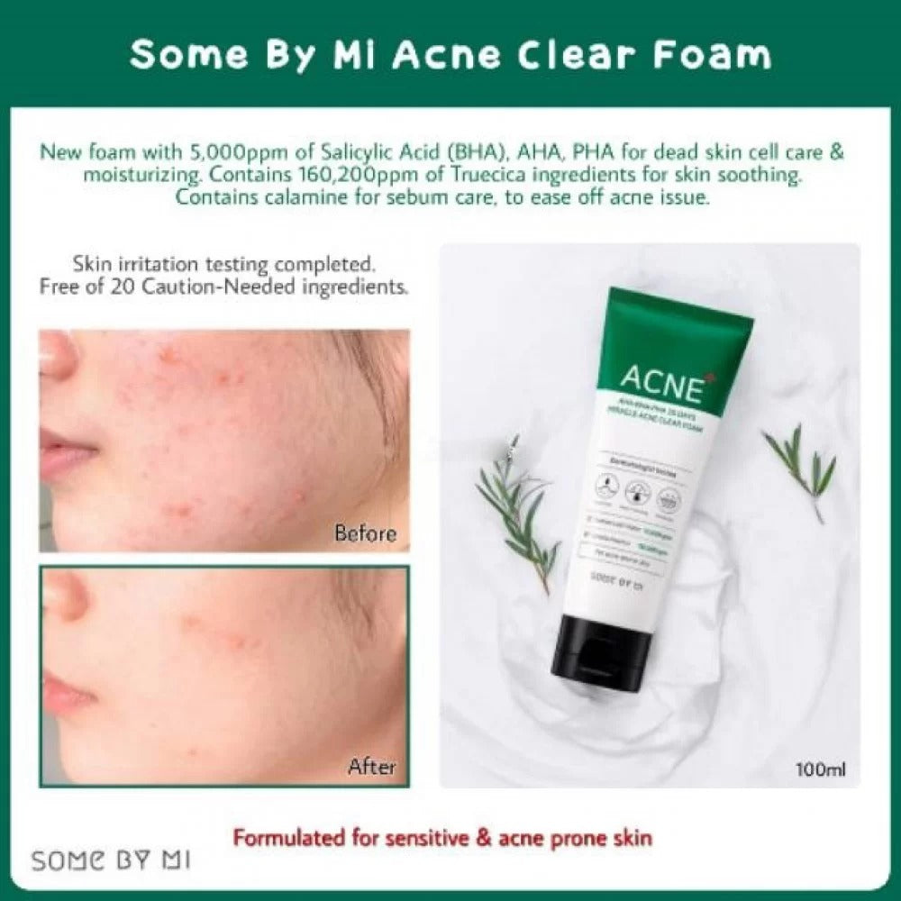 AHA BHA PHA 30 Days Miracle Acne Clear Foam 100ml - SOME BY MI